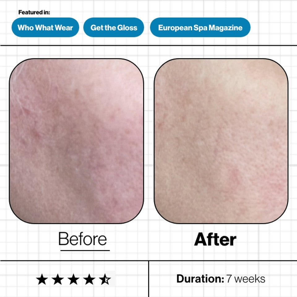 Skin Moisture IQ Supplement