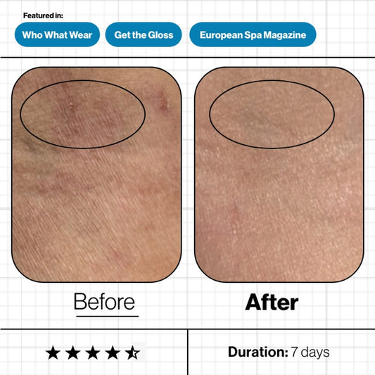 Skin Moisture Lock™ Supplement